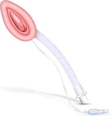 Disposable Silicone Laryngeal Airway – Paediatric 1.5 Electrosurgical Pencil